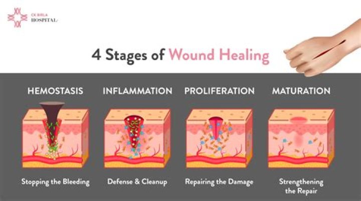 Is pain during wound healing normal?