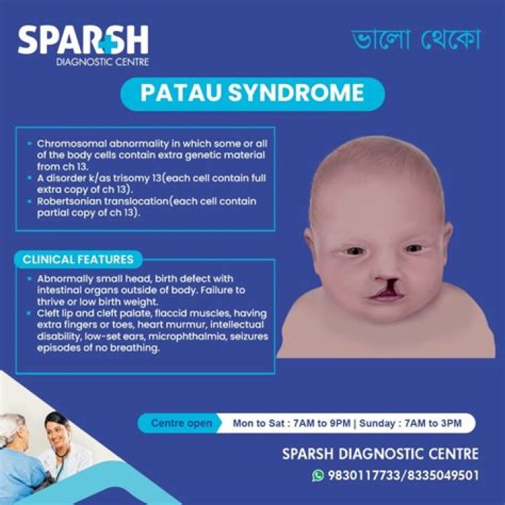 Is Patau syndrome genetic?