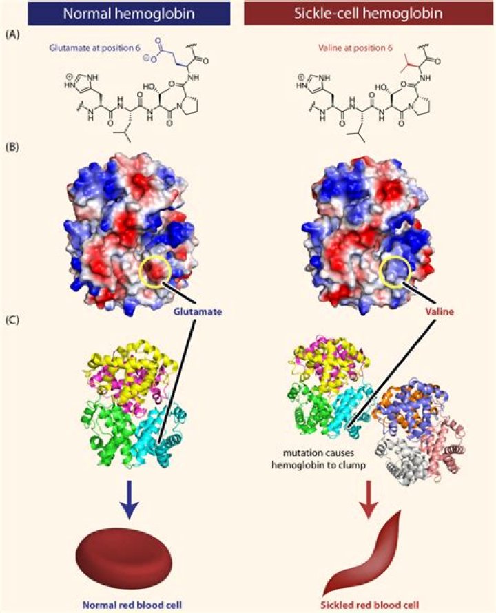 Is Sickle Cell Anemia a point mutation?