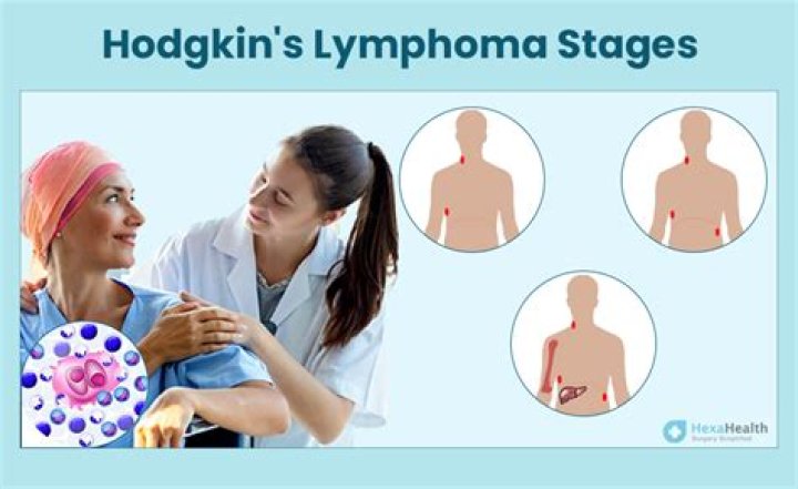 Is skin lymphoma curable?