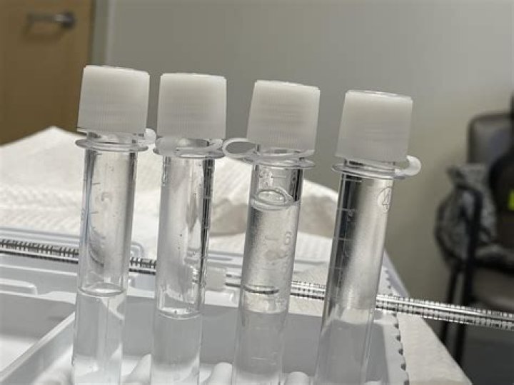 Is Spinal fluid clear?