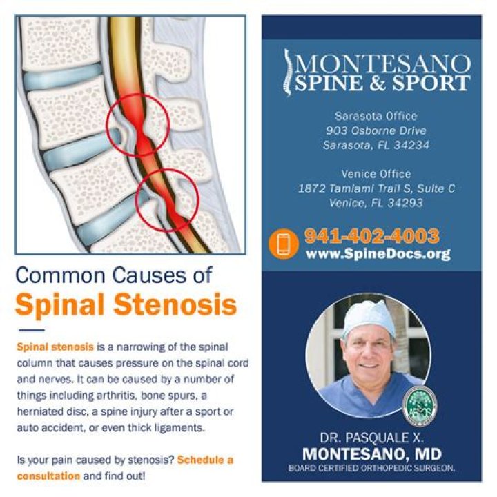 Is spinal stenosis serious?