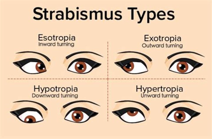 Is strabismus a disability?