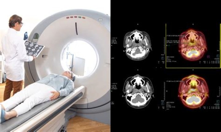 Is there an alternative to CT scans?