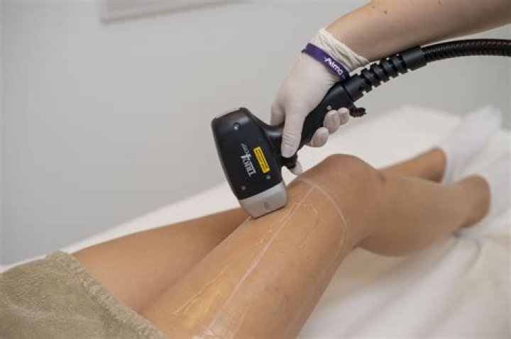 Is trio laser painful?