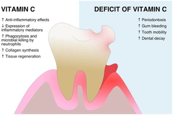 Is Vitamin C good after tooth extraction?