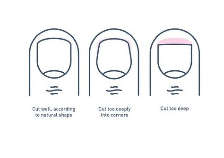 Should diabetics cut their own toenails?