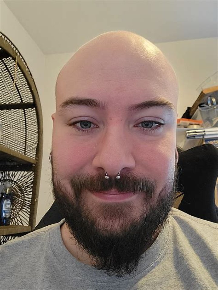 Should I Slug my face?