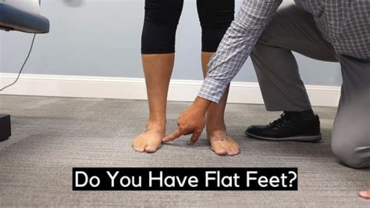 Should you do squats if you have flat feet?