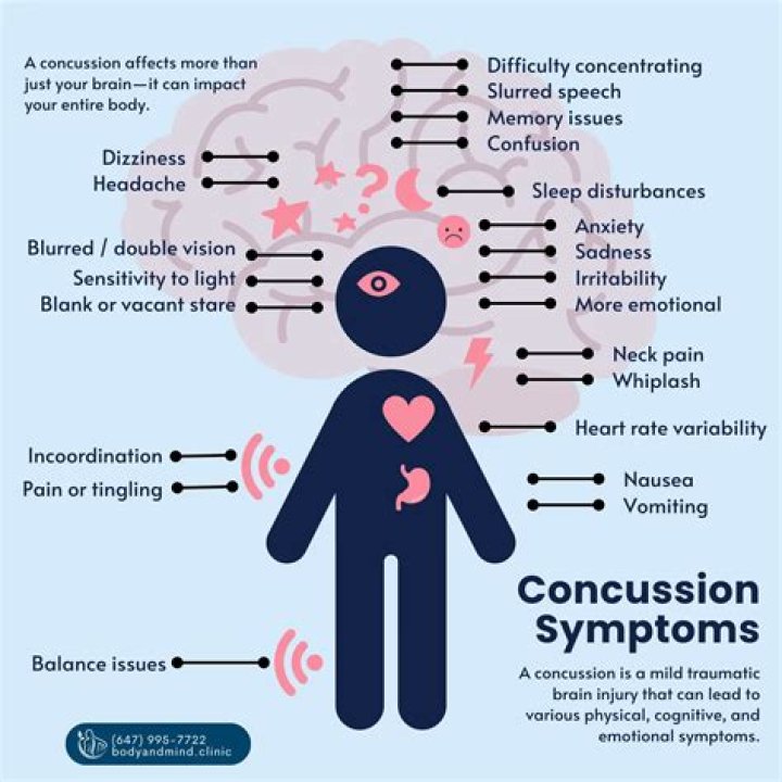 What are 3 delayed symptoms of a concussion?