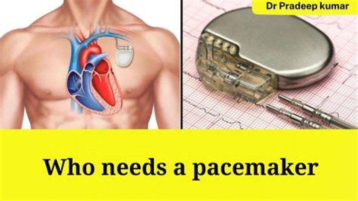 What are signs of needing a pacemaker?