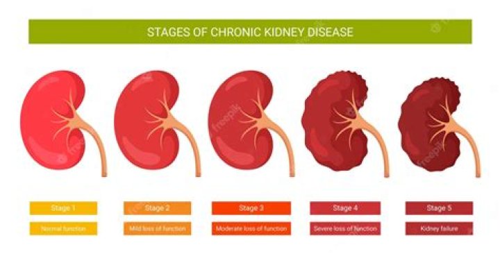 What are stages of kidney disease?