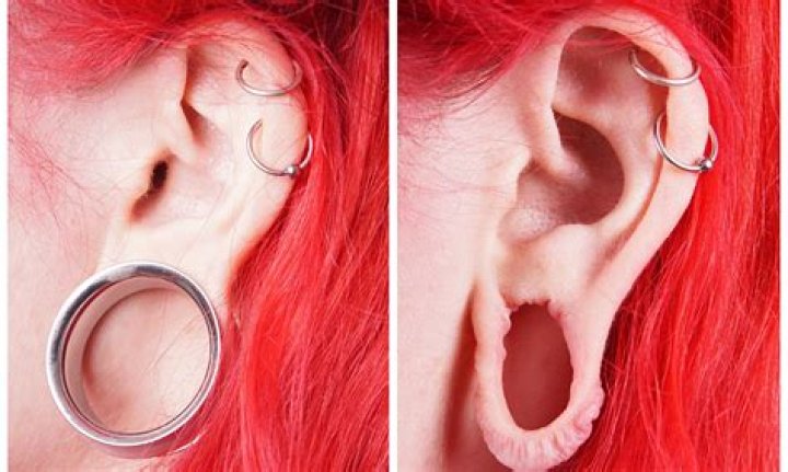 What are stretched ears called?