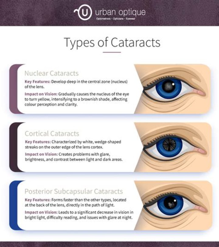 What are the 3 types of cataract lenses?