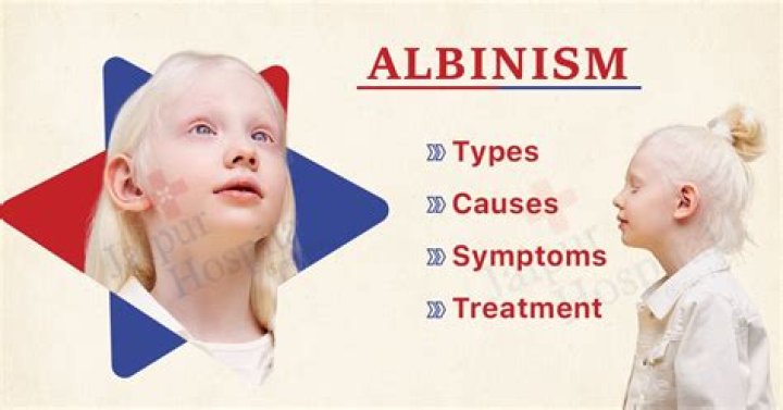 What are the 7 types of albinism?