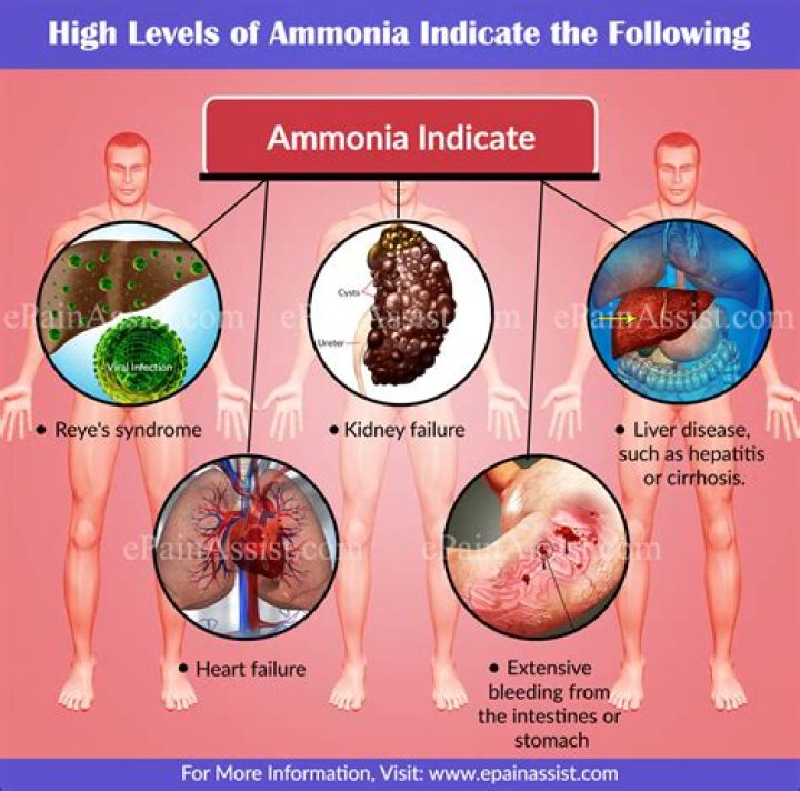 What are the signs of high ammonia levels?