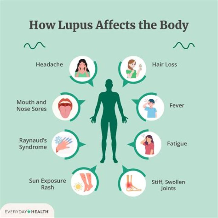 What are the symptoms of skin lupus?