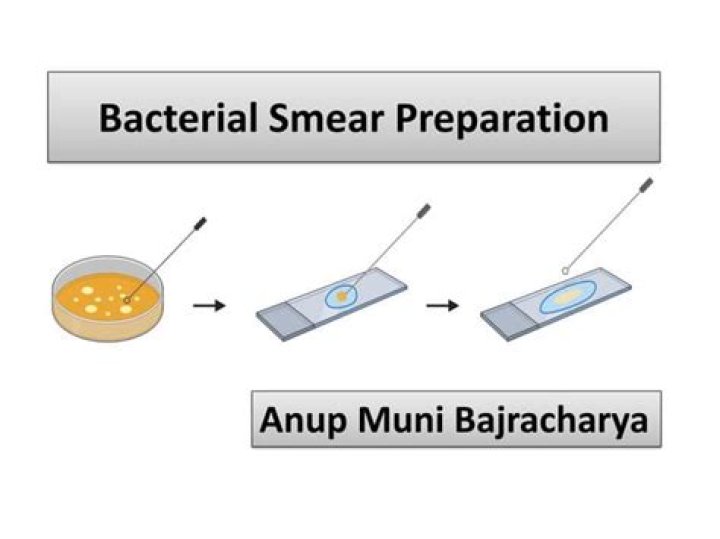 What are the two types of smear preparation?