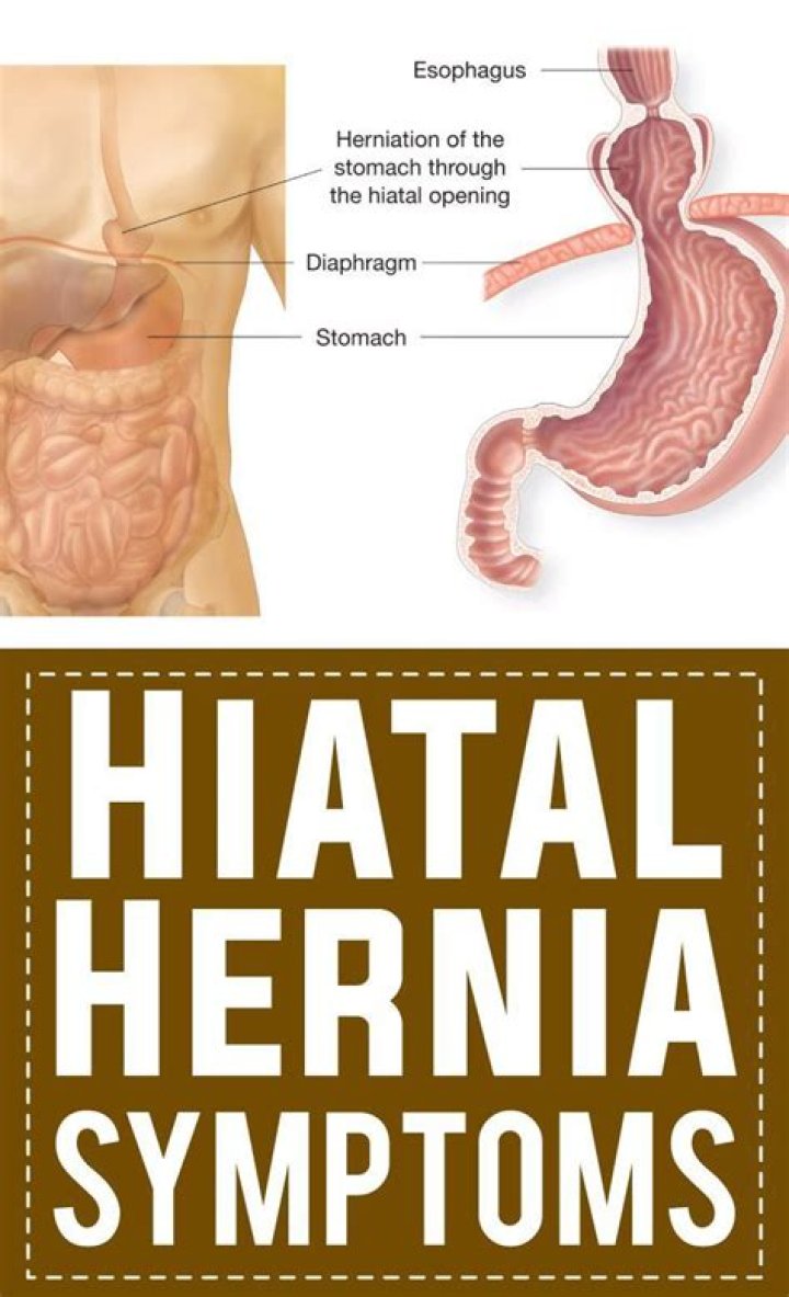 What are the warning signs of a hiatal hernia?