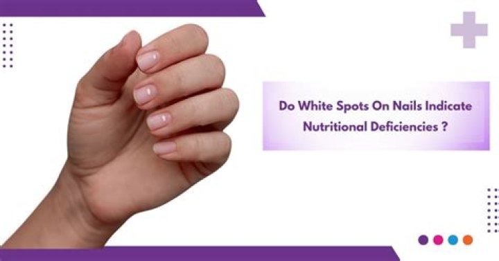 What are white spots on nails?