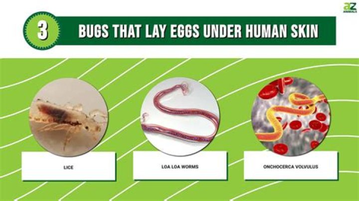 What bugs can lay eggs in your skin?
