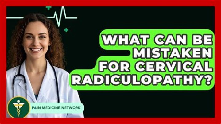 What can be mistaken for cervical radiculopathy?