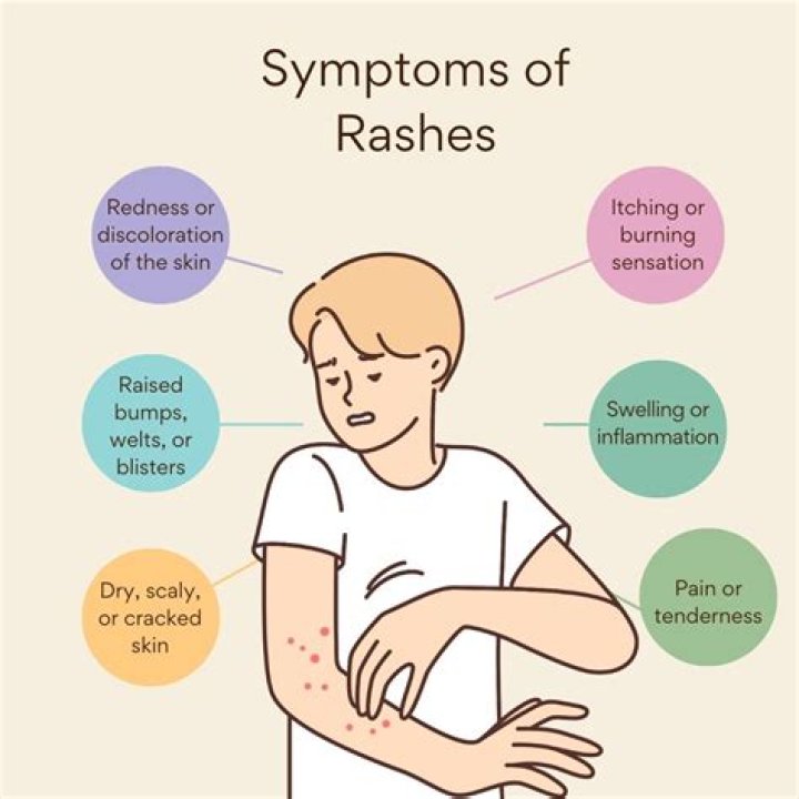 What can make a rash worse?