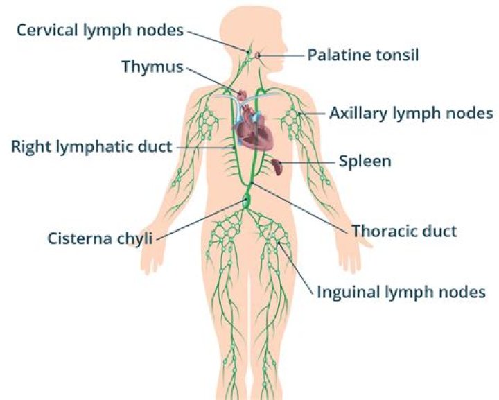 What cancers cause swollen lymph nodes?