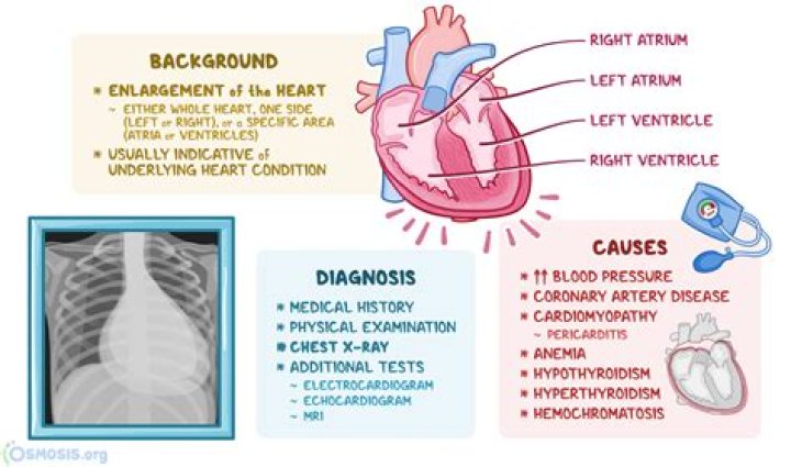 What causes a heart cough?