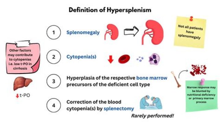 What causes hyposplenism?