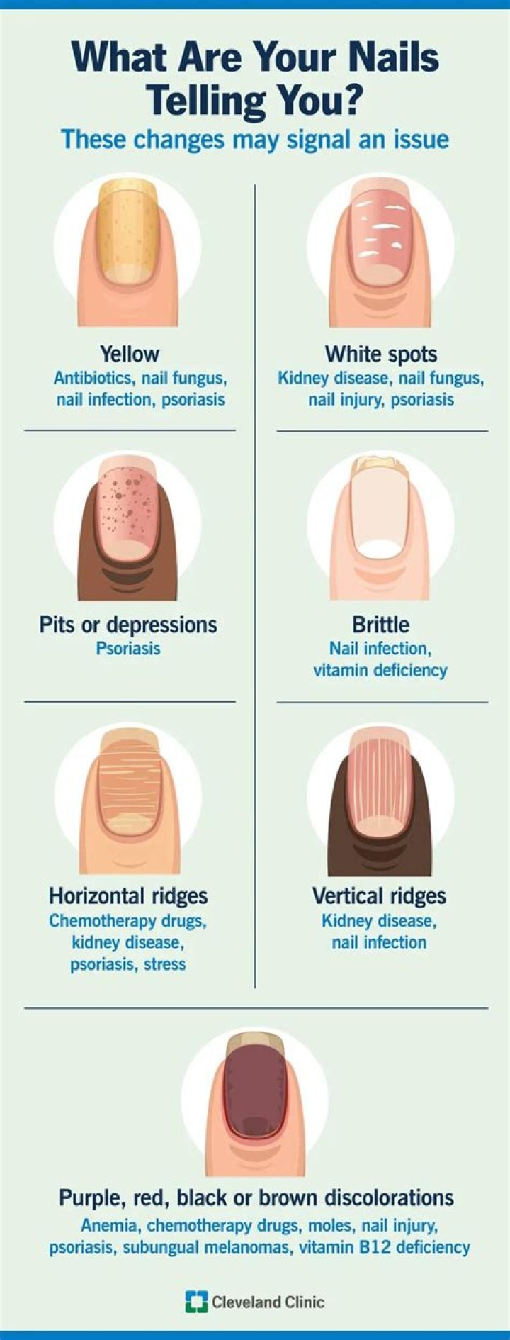What causes splits in fingernails?