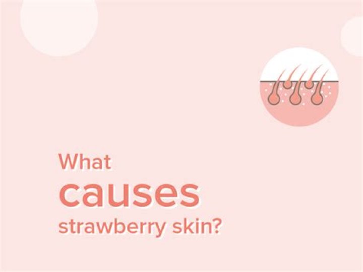 What causes strawberry milk?