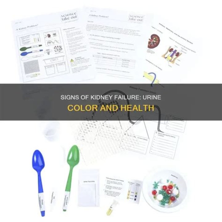 What color is your urine when kidneys are failing?