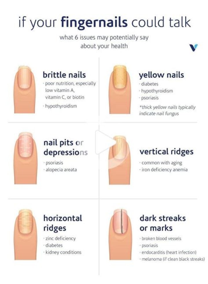 What color should your fingernails be?