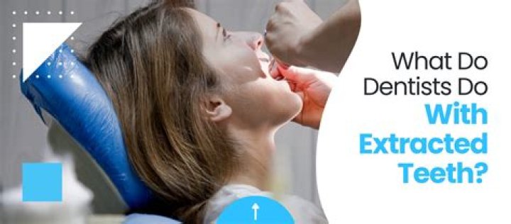 What do dentist do with extracted teeth?