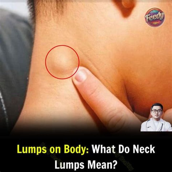 What do fatty lumps feel like?