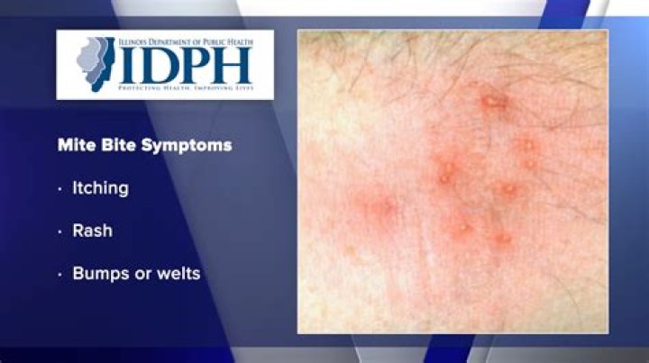 What do mite bites look like on your skin?