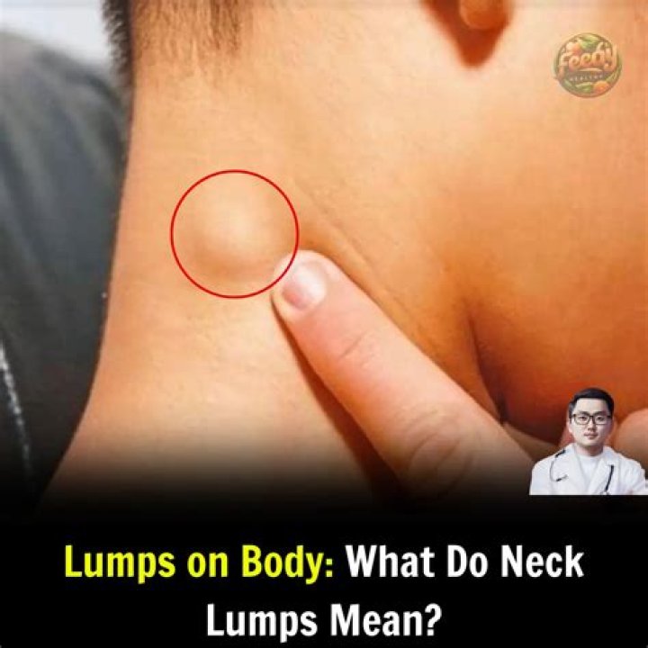 What do neck spots mean?