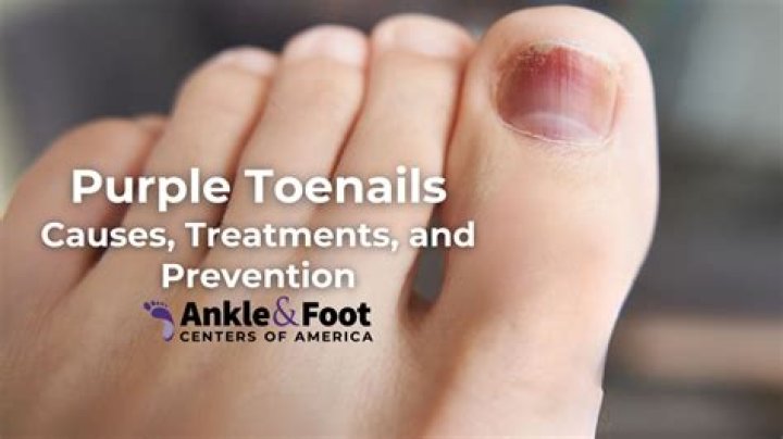 What do red painted toenails mean?