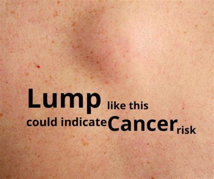 What does a cancerous armpit lump feel like?