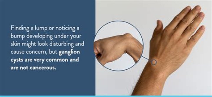 What does a cross on your wrist mean?