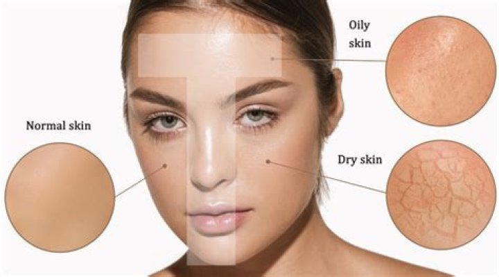 What does a healthy skin look like?