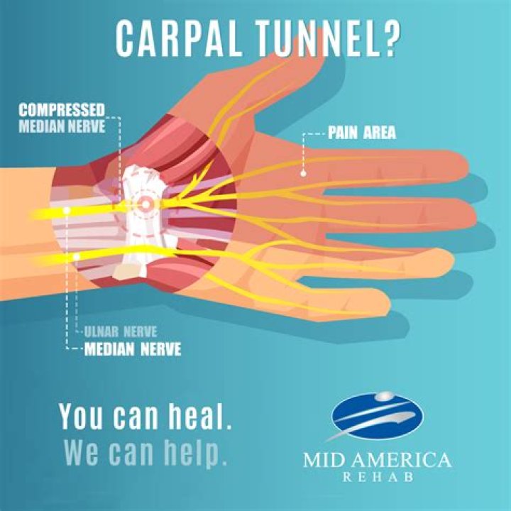 What does a neurologist do for carpal tunnel?