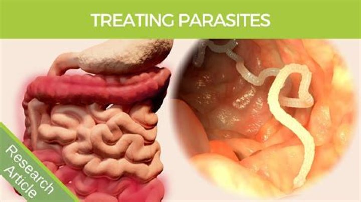 What does a stomach parasite feel like?