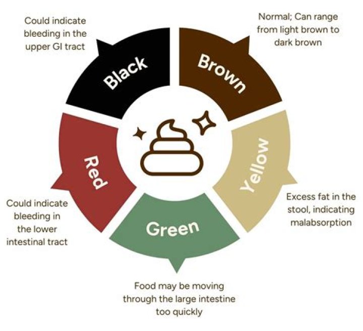 What does Beige poop mean?