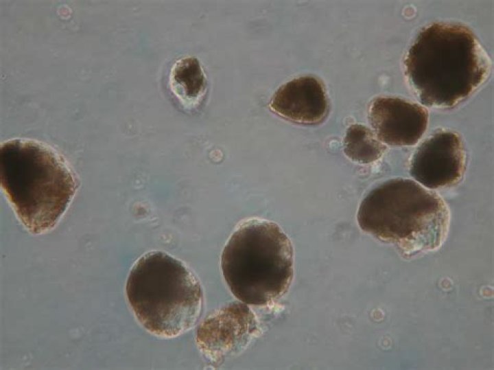 What does dust mite poop look like?