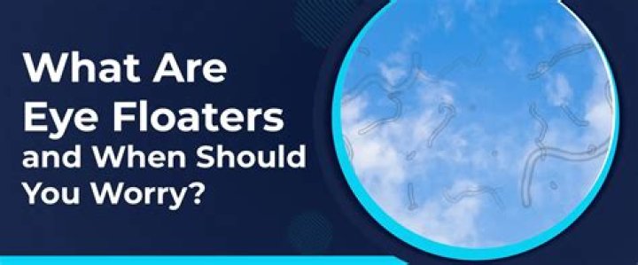 What does it mean when you see floaters?