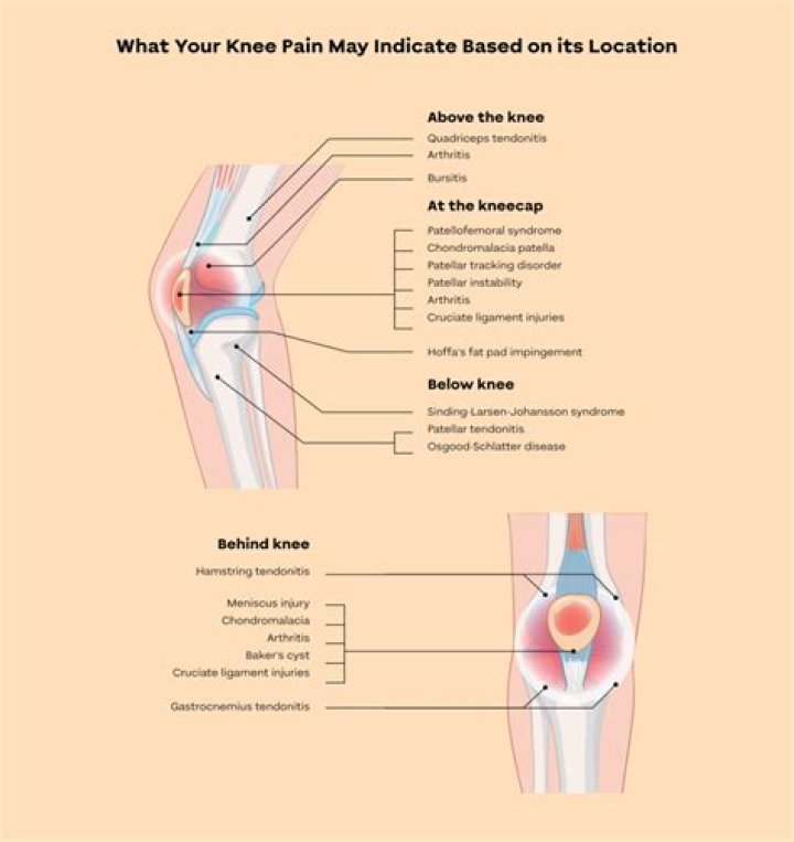 What does it mean when your knee feels numb?