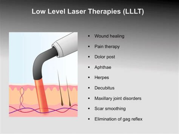 What does laser feel like?