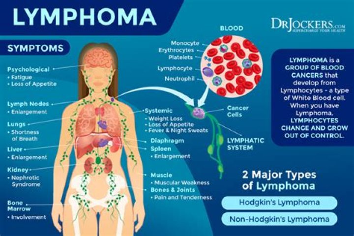 What does lymphoma look like on CBC?